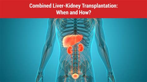 Combined Liver-Kidney Transplantation: When and How? - Dr Divakar Jain