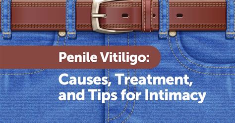 Penile Vitiligo: Causes, Treatment, and Tips for Intimacy | MyVitiligoTeam