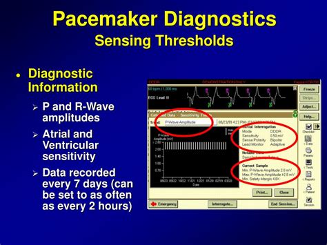 Ppt Pacemaker Diagnostics Powerpoint Presentation Free Download Id