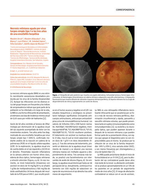 Pdf Acute Retinal Necrosis Herpes Simplex Virus Type 1 Within Three