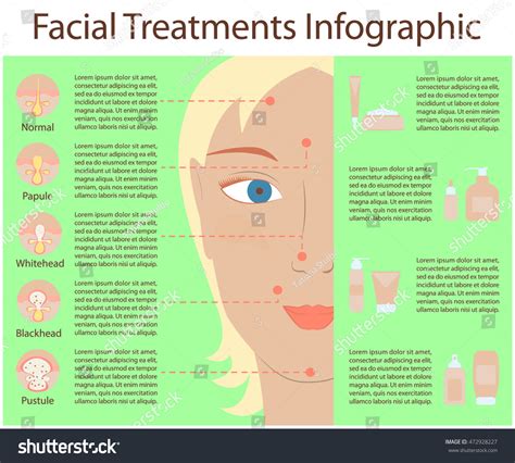 Poster Infographics Skin Problems Causes Problem Stock Vector (Royalty ...