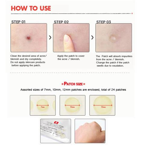 Acne Stickers Pimple Blemish Spot Stickers for facial treatment