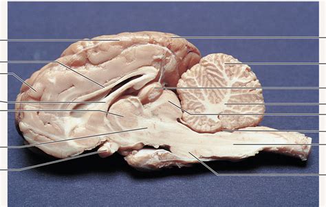 Sheep Brain Lab Assessment And Functions Diagram Quizlet