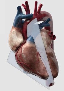 Discovering The Aorta Through Ultrasound Critical Care Sonography