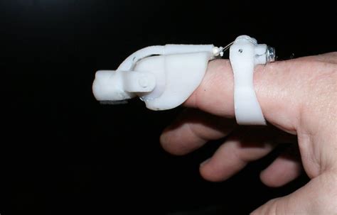 3d Printer Prosthetic Finger Hot Sex Picture