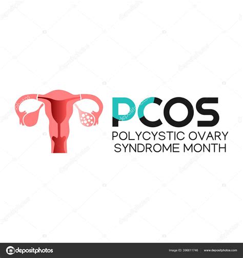 Vector Graphic Polycystic Ovary Syndrome Month Good Polycystic Ovary