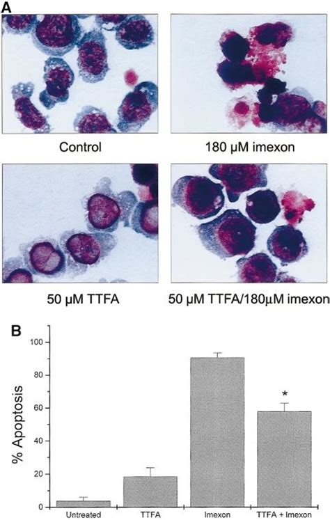 Protection Of Rpmi Myeloma Cells Against Imexon Induced Toxicity