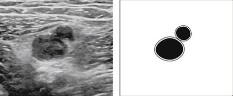 Peripheral Arterial and Venous Duplex Scanning Protocols | Radiology Key