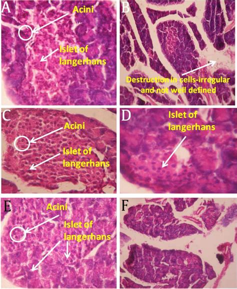 Histological Examinations Of 21 D Experimental Rat Pancreas Note A