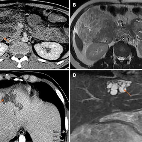 Computed Tomography Ct And Magnetic Resonance Imaging Mri A Plain