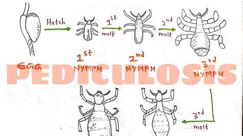 Pediculosis Pediculus Humanus Structure Life Cycle Transmission