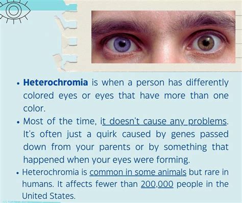 Heterochromia - MEDizzy