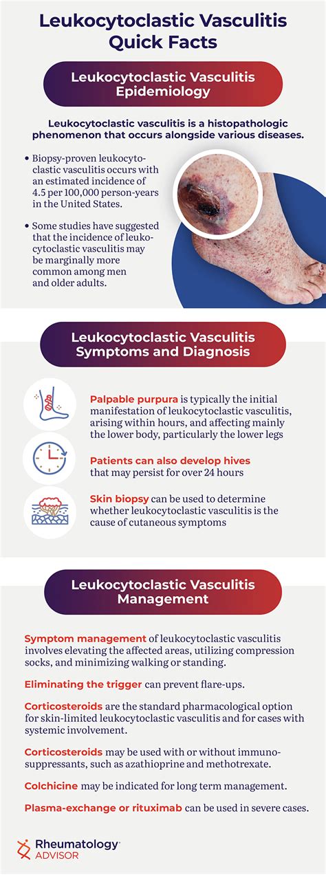 Leukocytoclastic Vasculitis - Rheumatology Advisor