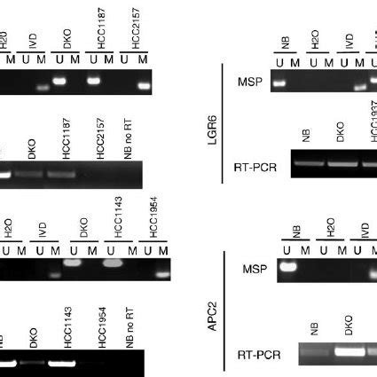 Common Gene Targets Of Mutation And Hypermethylation In Colon Cancer