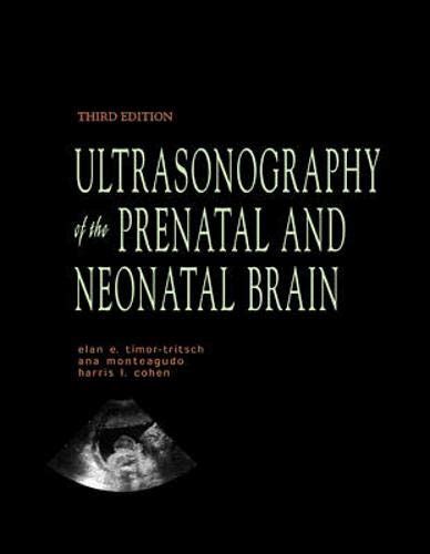 Amazon Ultrasonography Of The Prenatal And Neonatal Brain Timor Tritsch Ilan E Monteagudo