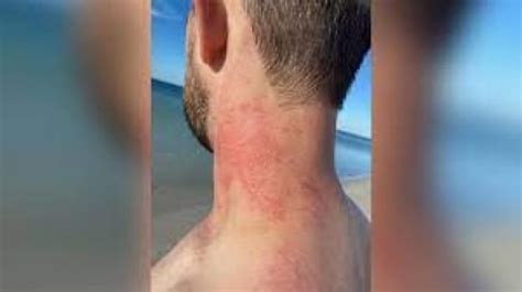 Pulpo se pone bravo y ataca a bañista en la playa