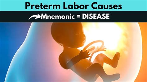 Preterm Labor Causes Mnemonic Causes Of Preterm Labor Obstetrics