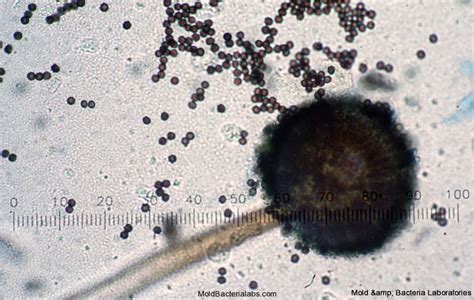 Mold Spores Contribute To Respiratory Disease And Allergic Reactions