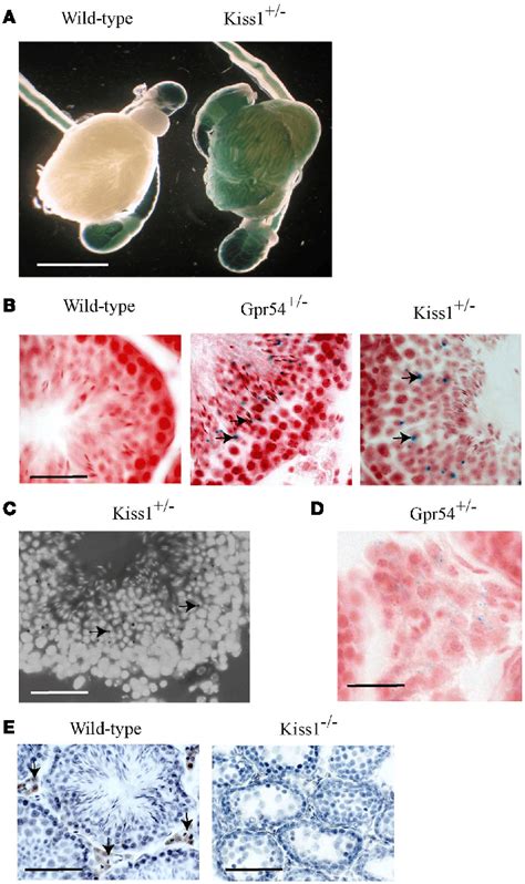 Kiss1 And Gpr54 Expression In The Mouse Testes A Expression Of