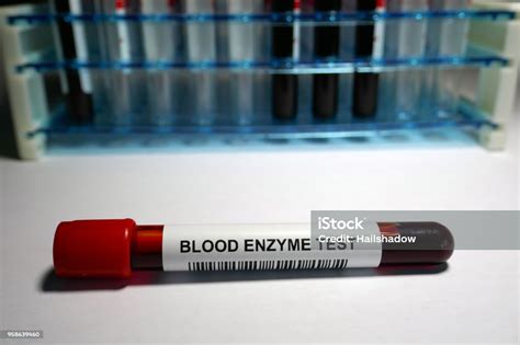 Blood Enzyme Test Stock Photo - Download Image Now - Analyzing, Blood ...