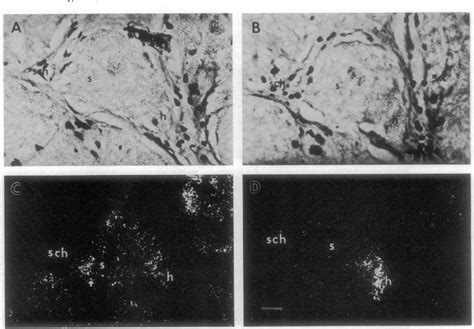 Figure From A High Molecular Weight Squid Neurofilament Protein