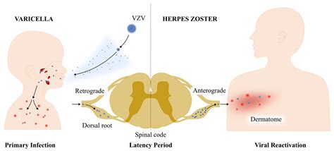 Biomolecules Free Full Text Exploring The Link Between Varicella