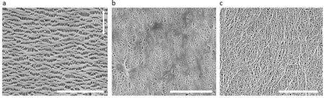 Sem Micrographs Of Microporous Polyolefin Membranes At The Surfaces