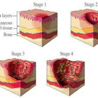 common pressure points in human body [6] | Download Scientific Diagram