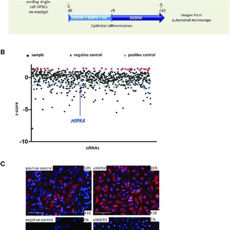 High Throughput Rnai Screen Identifies Hipk4 As An Inhibitor Of Skin