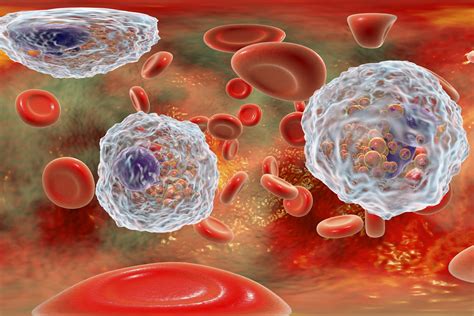 Eosinophils, Basophils and Monocytes: What Do These Lab Results Mean?