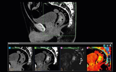 Iqon Elite Spectral Ct Lac Medical