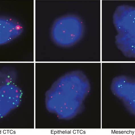 Different Types Of Ctcs Ctcs Were Identified By The Rna In Situ