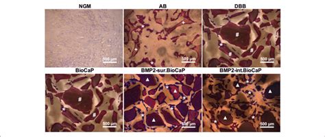 Histological Images In Higher Magnification Showing Newly Formed Bone