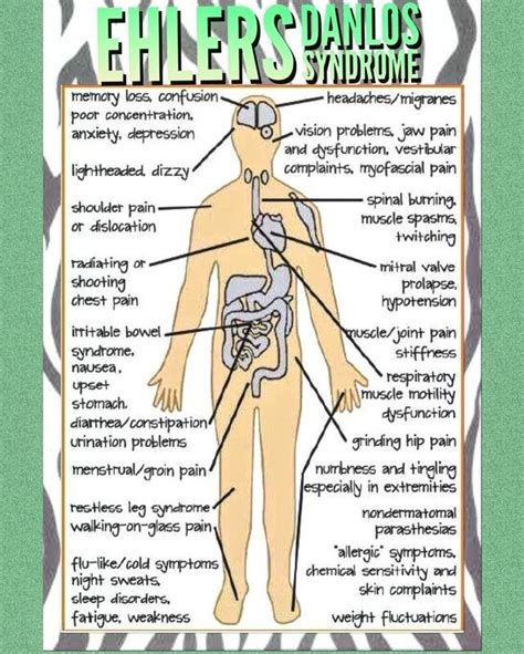 Pin on Ehlers-Danlos Syndrome