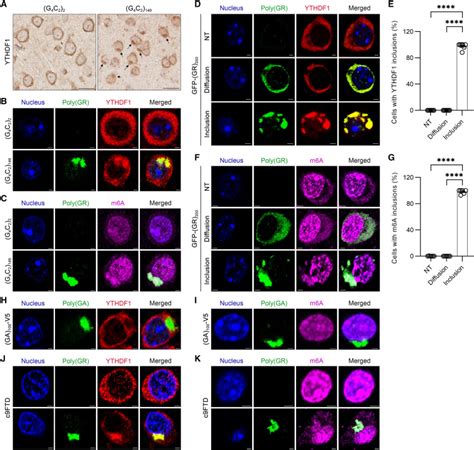 Poly Gr Interacts With Key Stress Granule Factors Promoting Its