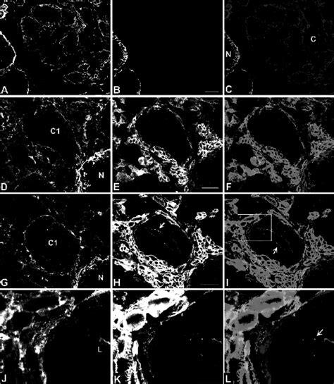 Confocal Laser Scanning Micrographs Of Simultaneous Detection Of 6