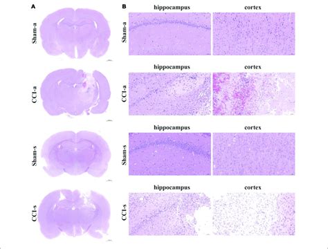 H E Staining Of Brain Tissues A The Brain Sections In Different