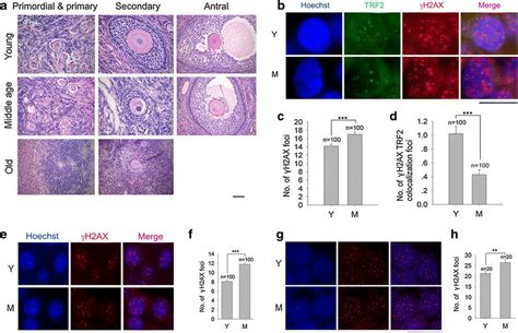 Dsbs And Telomeres In Granulosa Cells Or Cumulus Cells Of Antral Download Scientific Diagram