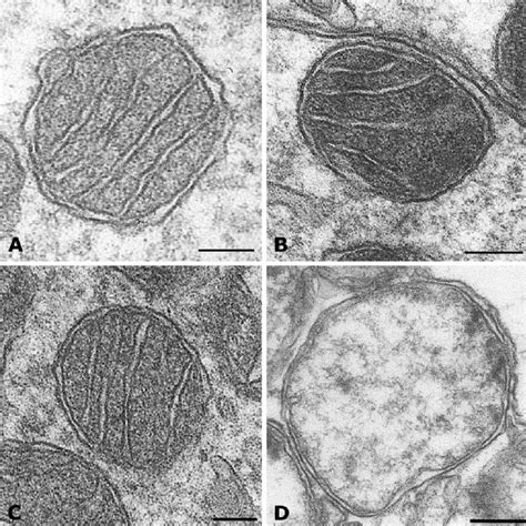 Transmission Electron Micrographs Of Mitochondria In Equine Oocytes A