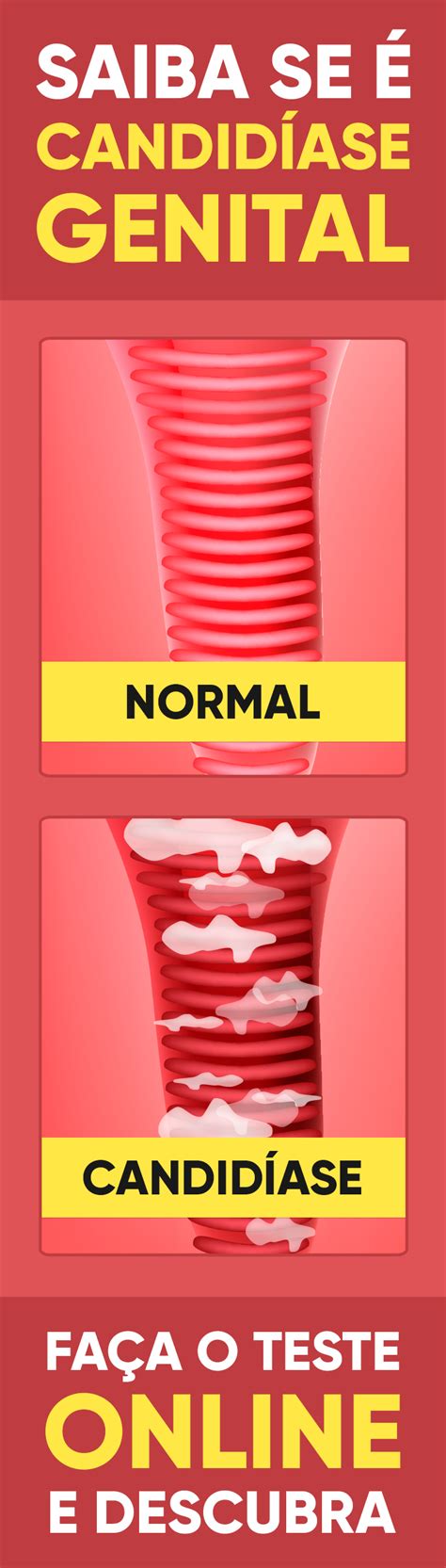 6 Sintomas Da Candidíase Para Ficar Atento Faça O Teste Online