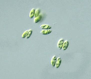 protist images scenedesmus