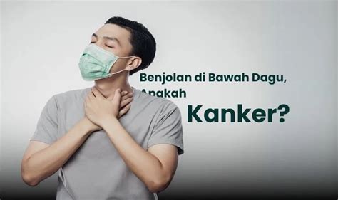 benjolan  bawah dagu penyebab  mengatasi  pencegahannya