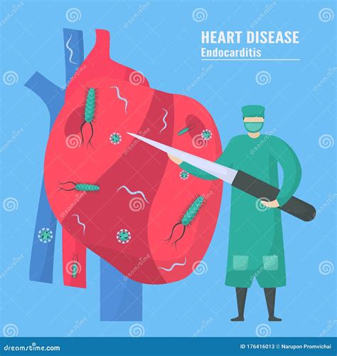 Tratamiento Cardiológico Esta Enfermedad Llama Endocarditis Es