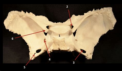 Sphenoid Superior View Diagram Quizlet