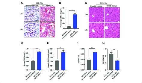 Metformin Improves Hepatic Steatosis And IR Via TFEB In HFD Fed Mice