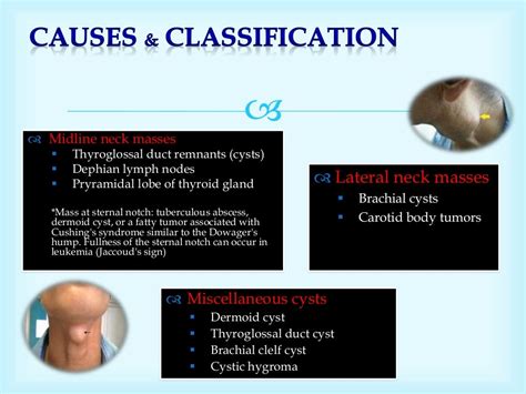 Neck Swelling History Taking Causes Classification