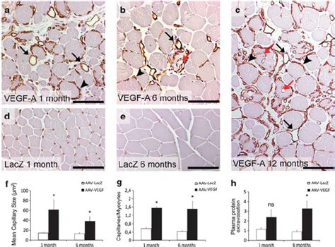 Immunohistochemical Stainings For Endothelial Cells CD31 AAV VEGF A