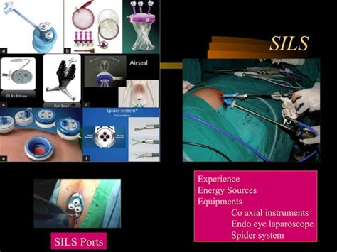 Ergonomics For Laparoscopic Surgeon Ppt