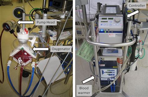 The Role Of Echocardiography In The Management Of Patients Supported By