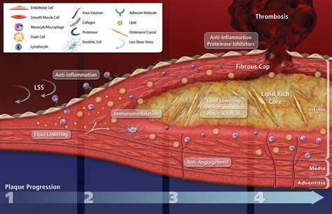 Molecular Imaging Of Atherosclerosis For Improving Diagnostic And